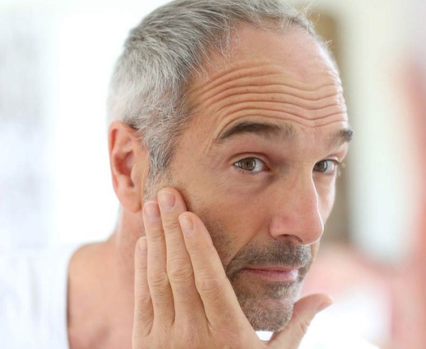 Căng da trán xuất hiện nhiều ở độ tuổi trung niên