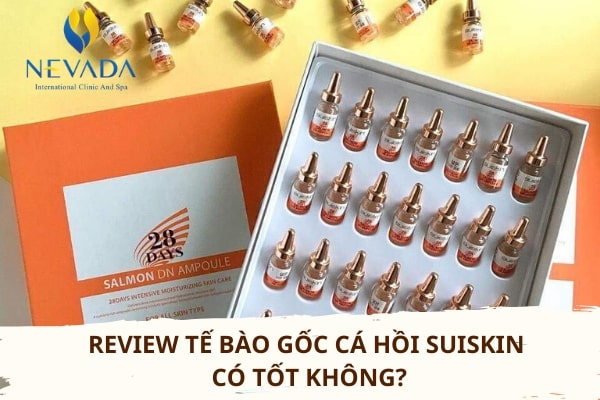 review te bao goc suiskin co tot khong 5